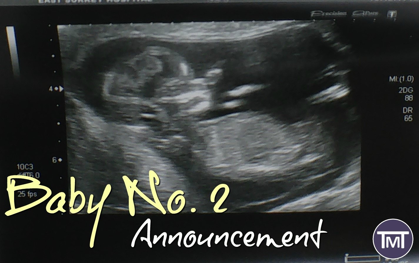 Another bun in the oven for us over at The Mummy Toolbox and we are excited! Here's how we "decided" to brave another and get lucky!